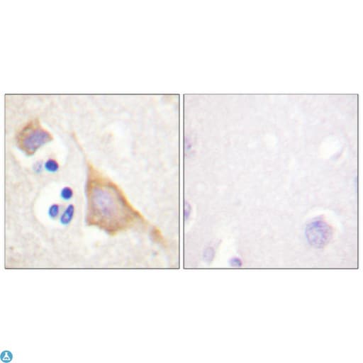 Polyclonal Rabbit anti-Human OPRM1 / Mu Opioid Receptor Antibody (IHC, WB)