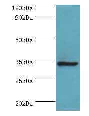 AIMP1 / EMAP II Antibody (aa25-180)