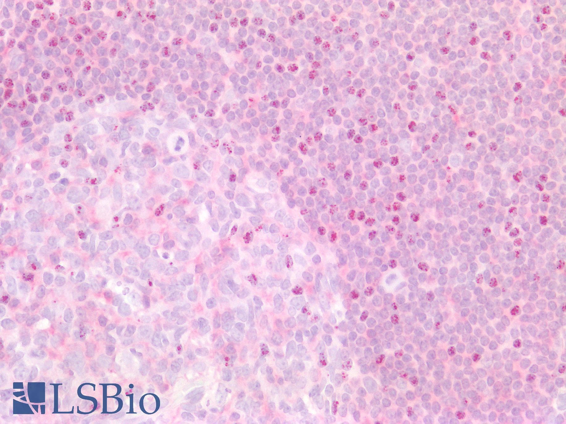 PathPlus™ Monoclonal Mouse anti-Human MSN / Moesin Antibody (clone 2C12, aa292-491, IHC, WB)