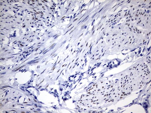 PR / Progesterone Receptor Antibody (aa1-298, clone OTI4D5)