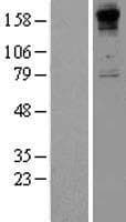 COL8A1 / Collagen VIII Alpha 1 Protein (Over-Expression Lysate Myc-DDK (Flag))