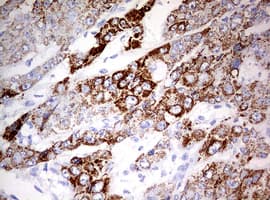 OTC Antibody (aa33-354, clone OTI1C4)