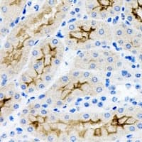 IHC-plus™ PNPLA3 / Adiponutrin Antibody