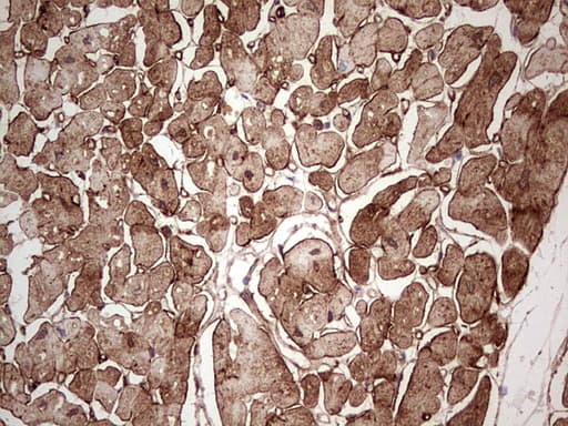 Monoclonal Mouse anti-Human Adiponectin Antibody (clone OTI3D3, aa19-244, IHC)