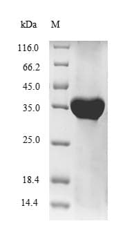 Human HLA-G Protein (Recombinant 6His-SUMO, N-terminus)