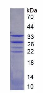 Mouse FOXO1 / FKHR Protein (Recombinant His-T7)