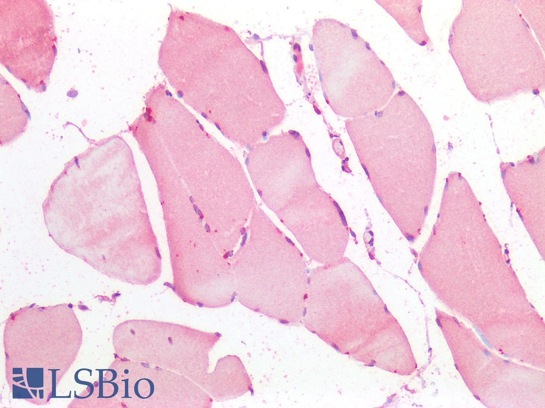 IHC-plus™ FOXC1 Antibody