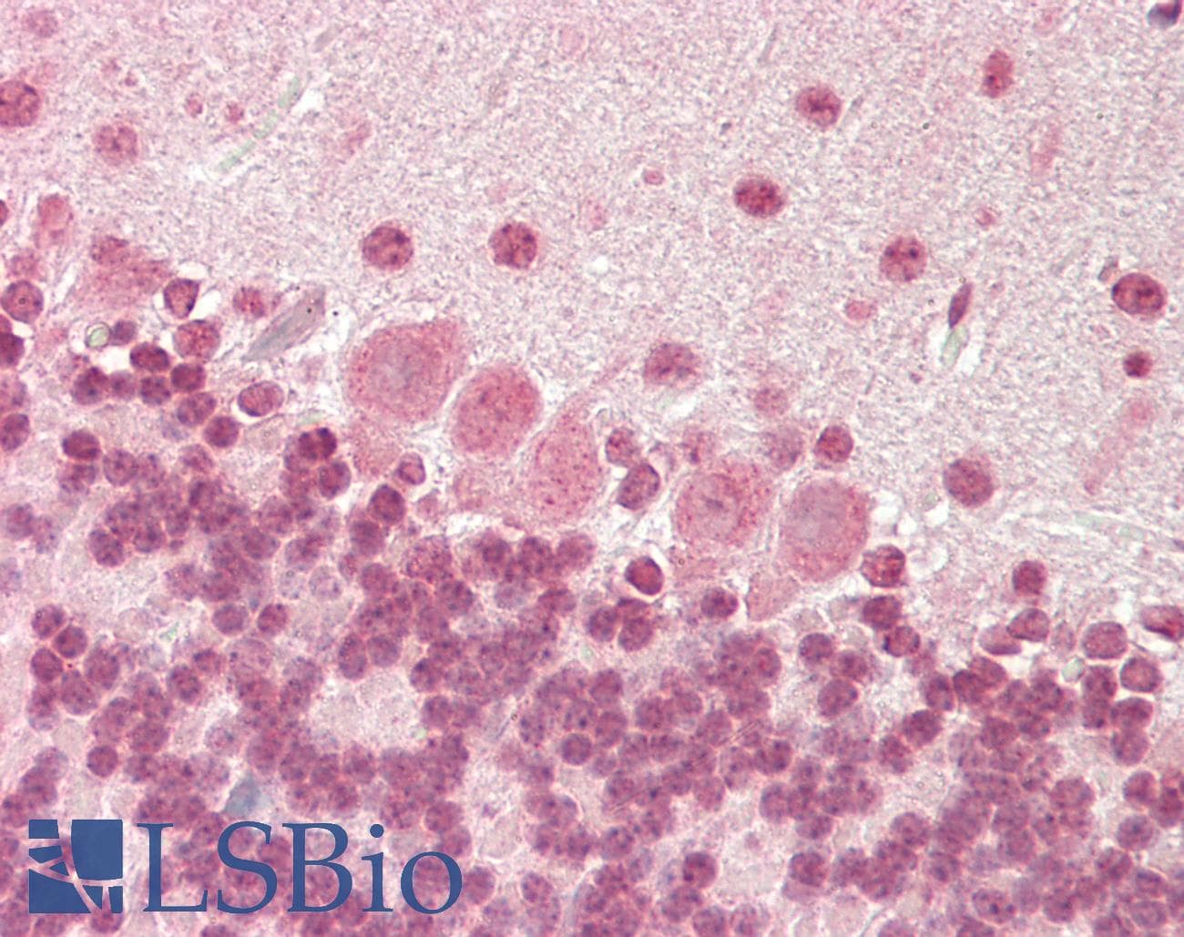 PathPlus™ BDNF Antibody