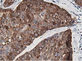 OSBP Antibody (clone OTI1F2)