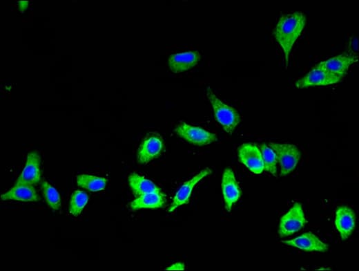SLC16A7 / MCT2 Antibody