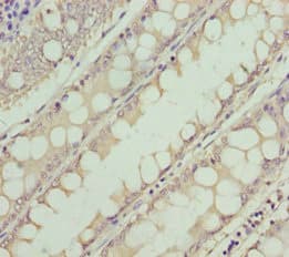 Polyclonal Rabbit anti-Human NEK8 Antibody (IHC)