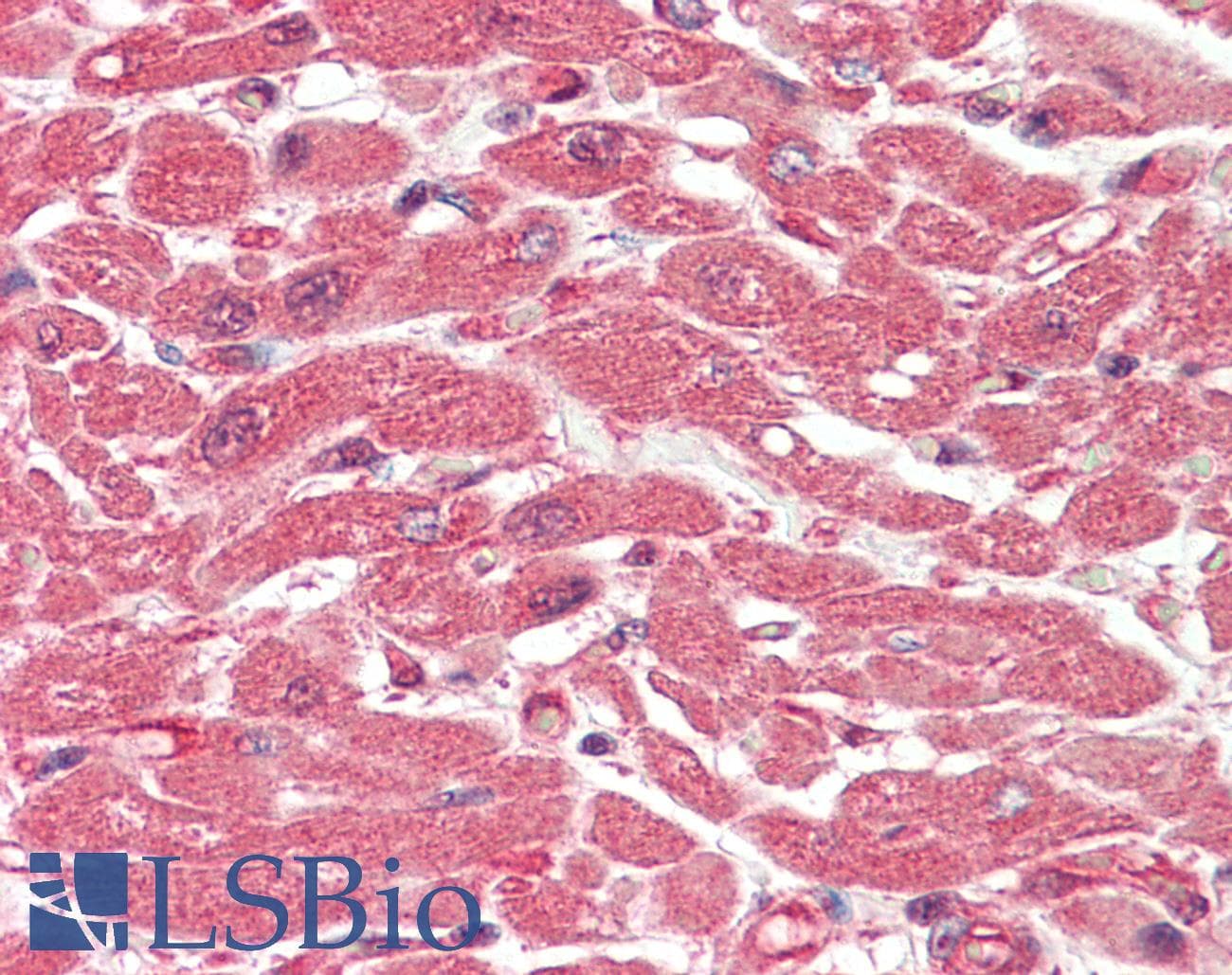 IHC-plus™ Monoclonal Rat anti-Human AHSA1 / AHA1 Antibody (clone 25F2.D9, IHC, WB)