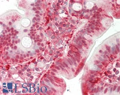 IHC-plus™ TMPRSS15 / Enterokinase Antibody (aa81-130)