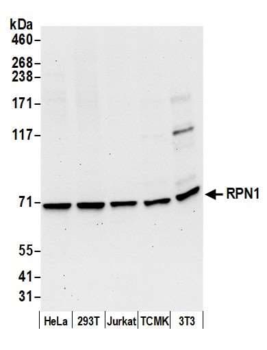 RPN1 / Ribophorin I Antibody (aa1-50)