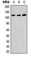 IHC-plus™ Polyclonal Rabbit anti-Human ADAMTS10 Antibody (Internal, IHC, WB)