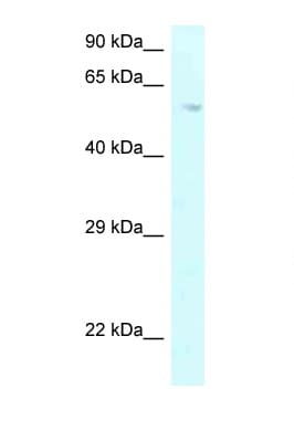 Polyclonal Rabbit anti-Human P4HA2 Antibody (aa289-338, WB)