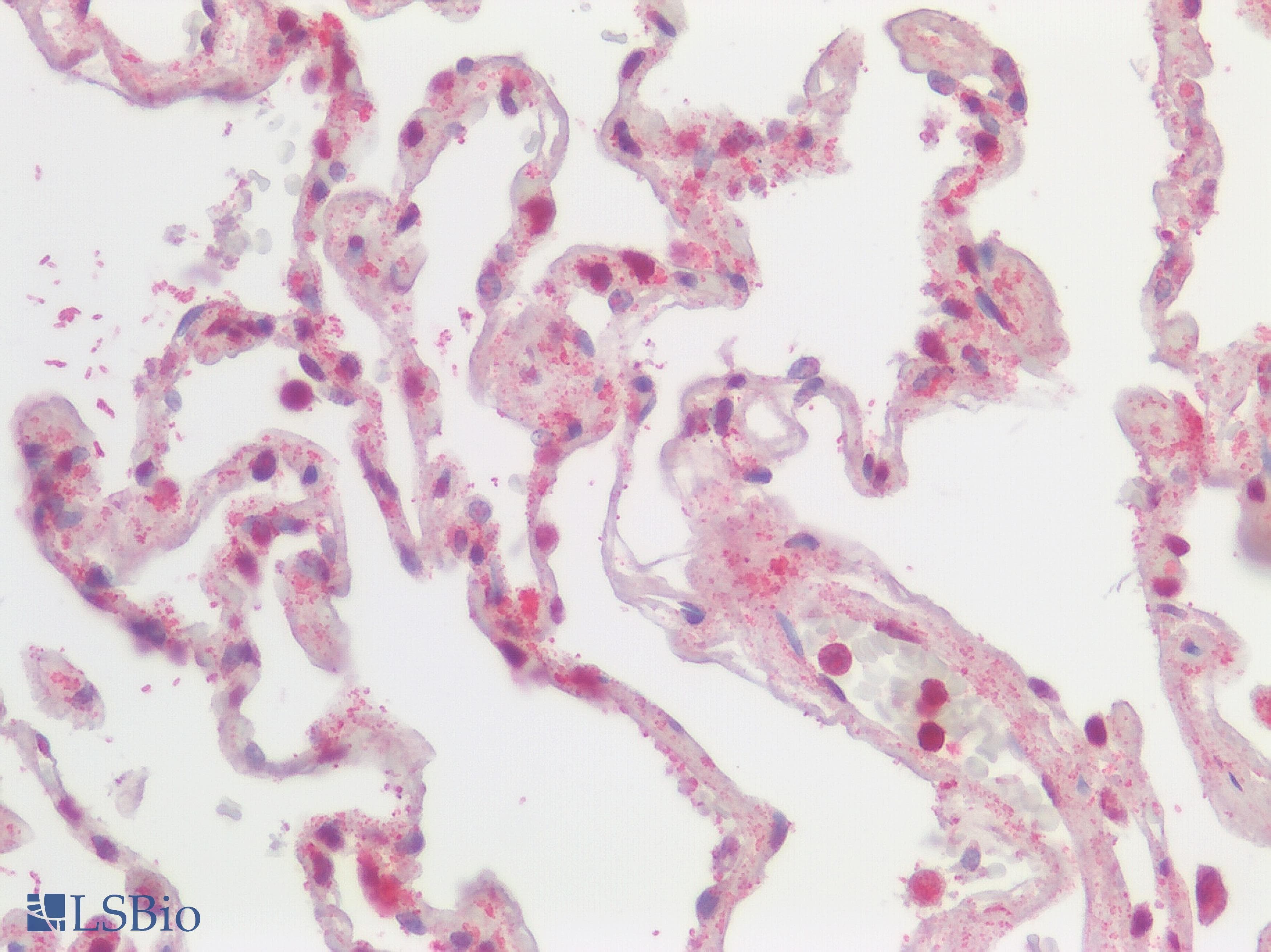 IHC-plus™ SSTR2 Antibody (Extracellular Domain)
