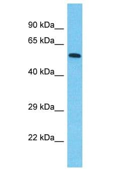 Polyclonal Rabbit anti-Human SPATA20 Antibody (aa378-427, WB)
