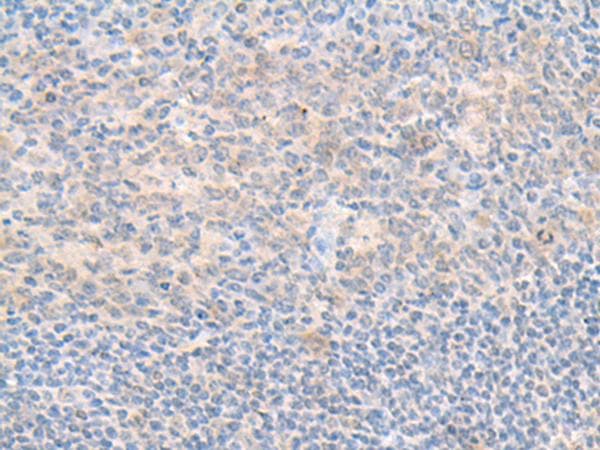 SMS / Spermine Synthase Antibody