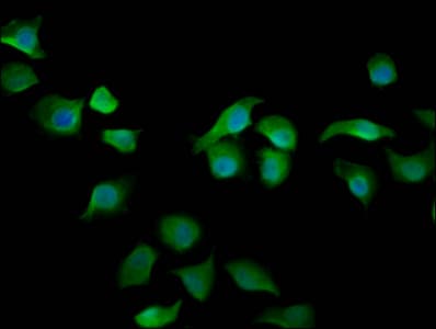 ARHGAP15 Antibody