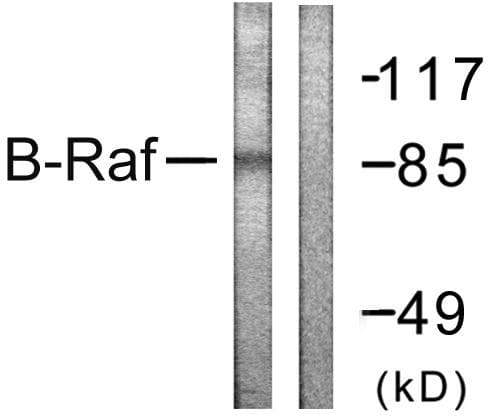 BRAF / B-Raf Antibody (p601)