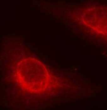 CFL1 / Cofilin Antibody (phospho-Ser3)