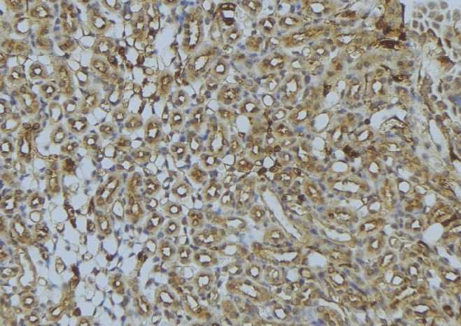 Polyclonal Rabbit anti-Human UQCRB Antibody (IHC, IF, WB)