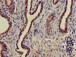 MAPK6 / ERK3 Antibody