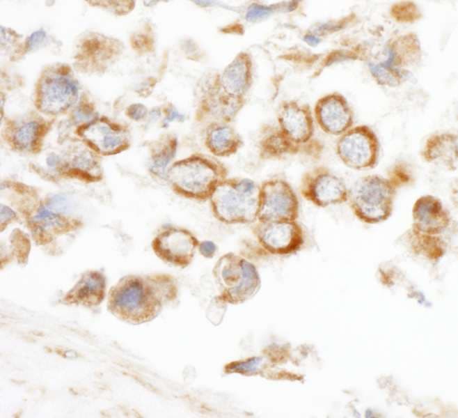 Polyclonal Rabbit anti-Human CNOT3 Antibody (aa525-575, IHC, WB)