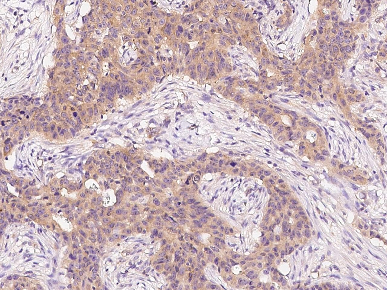 Polyclonal Rabbit anti-Human ARF3 Antibody (IHC)