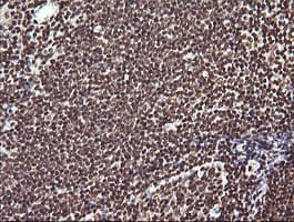 FAK / Focal Adhesion Kinase Antibody (clone OTI4D11)