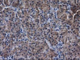 Monoclonal Mouse anti-Human DSTN / Destrin Antibody (clone OTI1B8, IHC, WB)