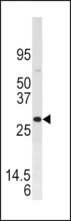 Polyclonal Rabbit anti-Human DUSP3 / VHR Antibody (aa1-30, IHC, WB)
