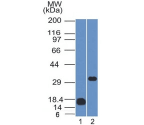 CD79B / CD79 Beta Antibody (clone IGB/1843)