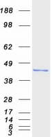 Human HSD3B2 Protein (Recombinant Myc-DDK (Flag))