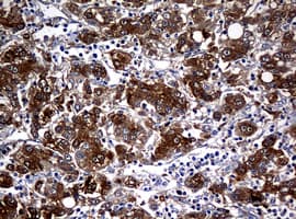 Monoclonal Mouse anti-Human NME1 / NM23 Antibody (clone OTI7F2, IHC, WB)