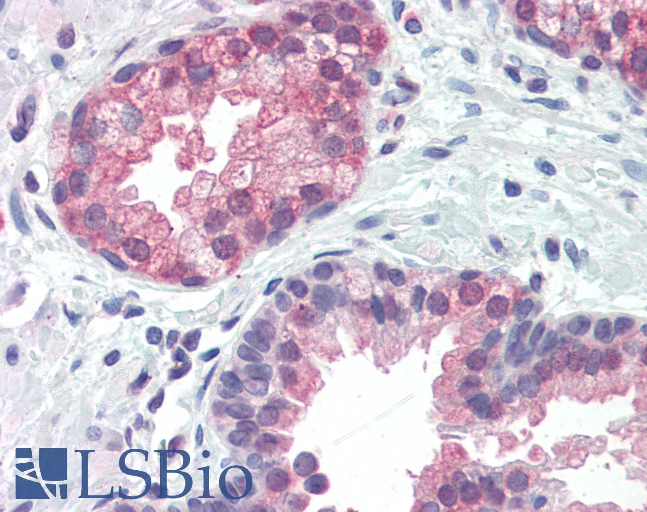 IHC-plus™ NIP3 / BNIP3 Antibody (aa112-124)