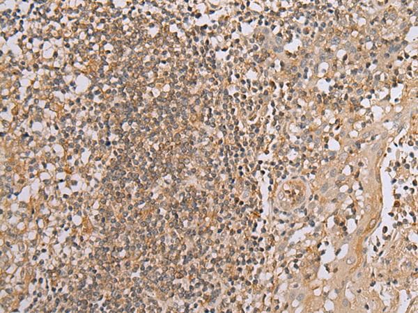 BAG2 Antibody