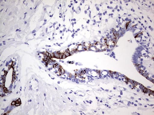 Monoclonal Mouse anti-Human KRT19 / CK19 / Cytokeratin 19 Antibody (clone OTI5F4, aa240-390, IHC, WB)