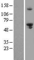 EXD1 Protein (Over-Expression Lysate Myc-DDK (Flag))