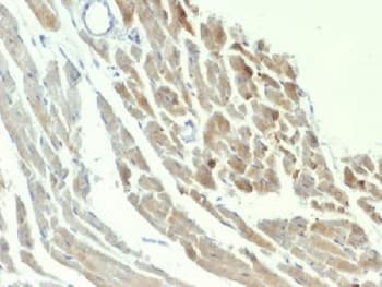 ENO2 / NSE Antibody (clone ENO2/1375)