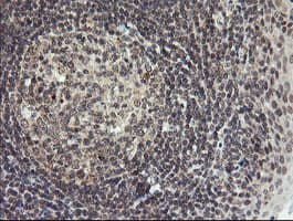 P3H1 / LEPRE1 Antibody (clone OTI1H3)