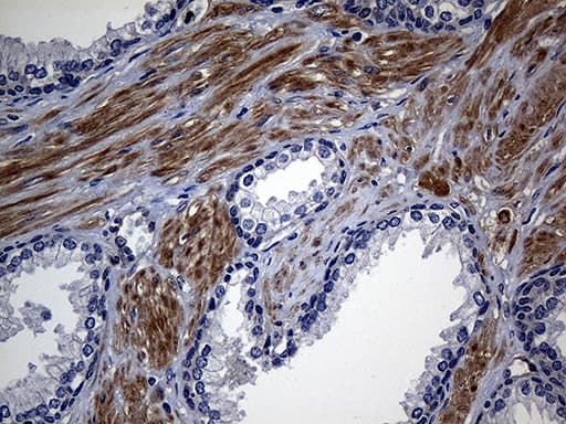 Monoclonal Mouse anti-Human M-PST / STM Antibody (clone OTI3G5, IHC, WB)