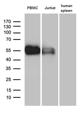 Monoclonal Mouse anti-Human VSIR / GI24 / VISTA Antibody (clone OTI1D10C1, WB)