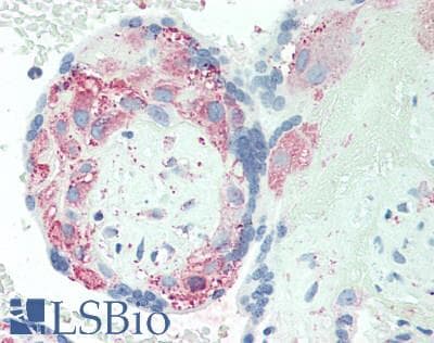 TMEM16B / ANO2 Antibody