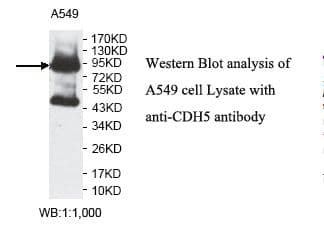 CD144 / CDH5 / VE Cadherin Antibody (aa769-784)