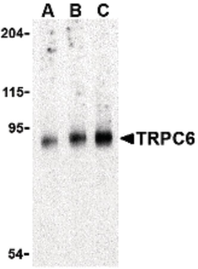 IHC-plus™ TRPC6 Antibody