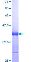 Human POLE2 Protein (Recombinant GST, N-terminus)