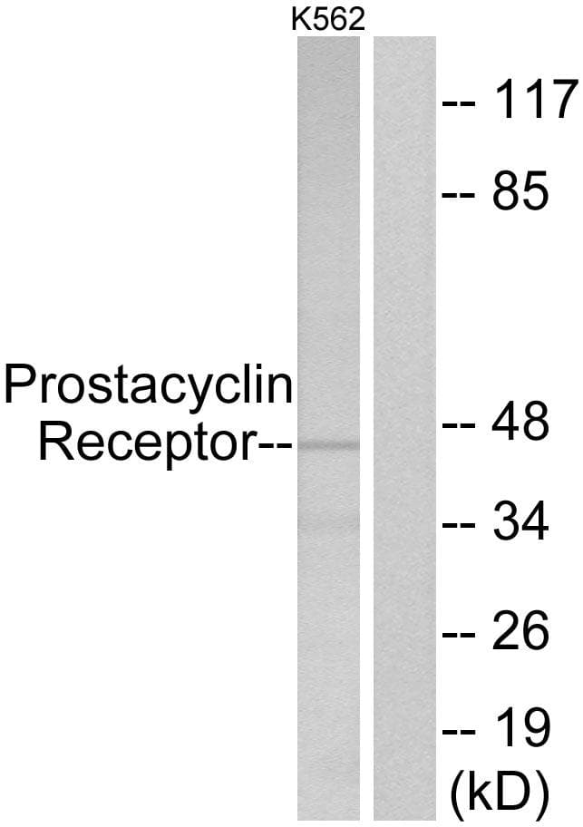 Polyclonal Rabbit anti-Human PTGIR / IP Receptor Antibody (IF, WB)