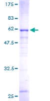 Human SULT4A1 / Sulfotransferase 4A1 Protein (Recombinant GST)